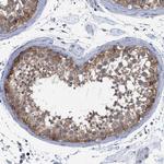 FHOD3 Polyclonal Antibody