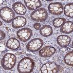 TTLL11 Polyclonal Antibody