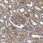 TPK1 Antibody in Immunohistochemistry (Paraffin) (IHC (P))