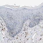TPK1 Antibody in Immunohistochemistry (Paraffin) (IHC (P))
