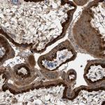 TPK1 Antibody in Immunohistochemistry (IHC)