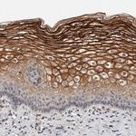 CYSRT1 Antibody in Immunohistochemistry (Paraffin) (IHC (P))