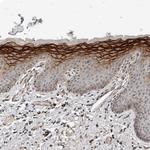 CYSRT1 Antibody in Immunohistochemistry (Paraffin) (IHC (P))