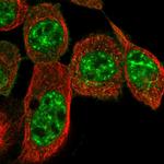 CYSRT1 Polyclonal Antibody