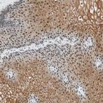CYSRT1 Antibody in Immunohistochemistry (Paraffin) (IHC (P))