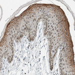 CYSRT1 Antibody in Immunohistochemistry (Paraffin) (IHC (P))