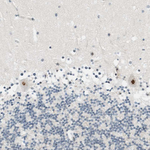 CYSRT1 Antibody in Immunohistochemistry (Paraffin) (IHC (P))