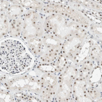 CYSRT1 Antibody in Immunohistochemistry (Paraffin) (IHC (P))