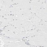 CYSRT1 Antibody in Immunohistochemistry (Paraffin) (IHC (P))