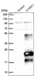CYSRT1 Antibody in Western Blot (WB)