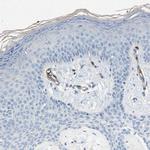 Dysferlin Antibody in Immunohistochemistry (IHC)