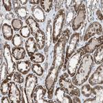 APC11 Antibody in Immunohistochemistry (Paraffin) (IHC (P))