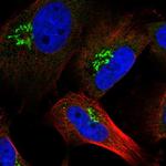 RNF157 Polyclonal Antibody