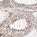 RNF157 Antibody in Immunohistochemistry (IHC)