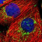 ECHS1 Polyclonal Antibody