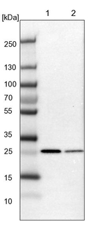 ECHS1 Antibody in Western Blot (WB)