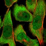 COPS3 Polyclonal Antibody