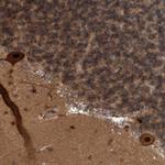 COPS3 Antibody in Immunohistochemistry (Paraffin) (IHC (P))