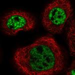 MFSD11 Polyclonal Antibody