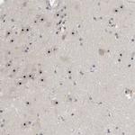 NOL11 Antibody in Immunohistochemistry (Paraffin) (IHC (P))