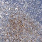 ARPC5L Polyclonal Antibody