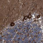 CDR2L Antibody in Immunohistochemistry (Paraffin) (IHC (P))