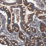 CDR2L Antibody in Immunohistochemistry (Paraffin) (IHC (P))