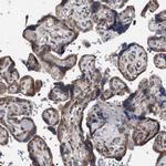 CDR2L Antibody in Immunohistochemistry (Paraffin) (IHC (P))