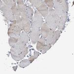 CDR2L Antibody in Immunohistochemistry (Paraffin) (IHC (P))