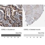 CDR2L Antibody