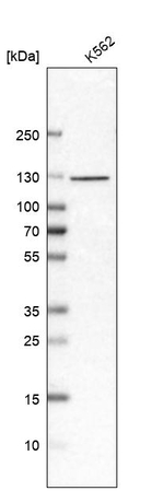 EFTUD2 Antibody in Western Blot (WB)
