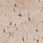 KIF9 Antibody in Immunohistochemistry (Paraffin) (IHC (P))