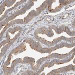 KIF9 Antibody in Immunohistochemistry (Paraffin) (IHC (P))