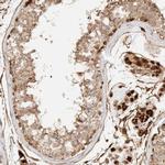 KIF9 Antibody in Immunohistochemistry (IHC)