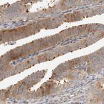 KIF9 Polyclonal Antibody