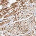 KIF9 Antibody in Immunohistochemistry (Paraffin) (IHC (P))