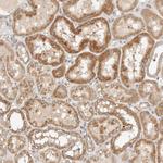 KIF9 Antibody in Immunohistochemistry (Paraffin) (IHC (P))