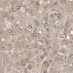 MPRIP Antibody in Immunohistochemistry (IHC)