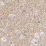 MPRIP Antibody in Immunohistochemistry (IHC)