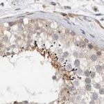 MPRIP Antibody in Immunohistochemistry (IHC)