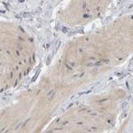 MPRIP Antibody in Immunohistochemistry (IHC)