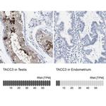 TACC3 Antibody