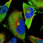 TACC3 Antibody in Immunocytochemistry (ICC/IF)