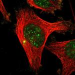 CENPU Polyclonal Antibody