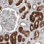 ALAD Antibody in Immunohistochemistry (Paraffin) (IHC (P))