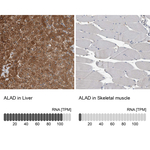 ALAD Antibody in Immunohistochemistry (Paraffin) (IHC (P))