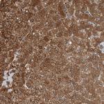 ALAD Antibody in Immunohistochemistry (Paraffin) (IHC (P))