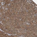ALAD Antibody in Immunohistochemistry (Paraffin) (IHC (P))