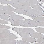 ALAD Antibody in Immunohistochemistry (Paraffin) (IHC (P))