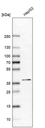 ALAD Antibody in Western Blot (WB)